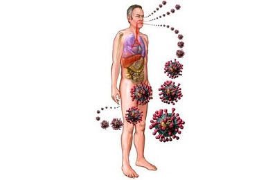 Гнойно геморрагическая пневмония при гриппе thumbnail