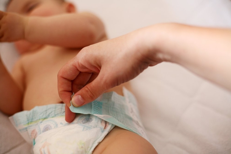 Чем лечить опрелости у новорожденных?
