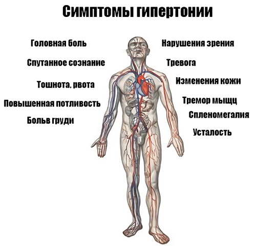 Симптомы гипертонии