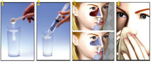 Пошаговая инструкция тем, кто хочет правильно промывать нос при вирусном заболевании и простуде. Растворы и комбинированные схемы
