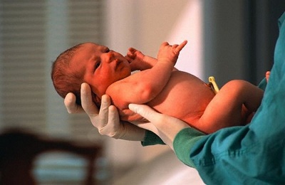 Синдром легочной гипертензии у новорожденных thumbnail
