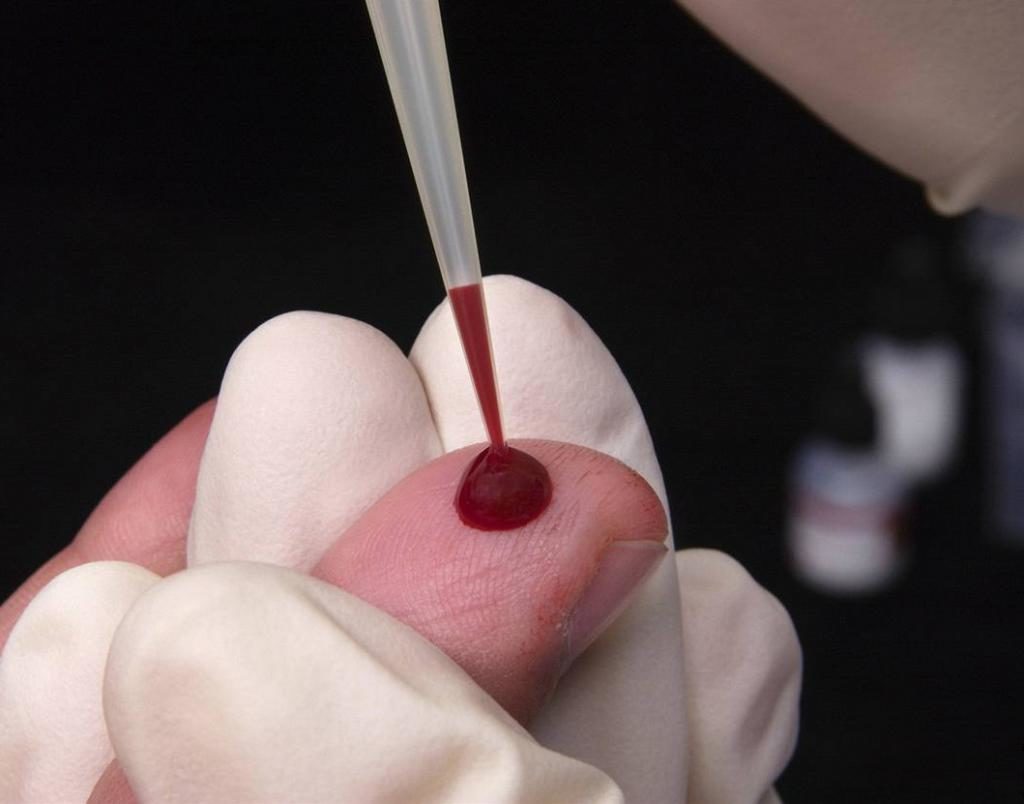Отбор крови из пальца ребенка