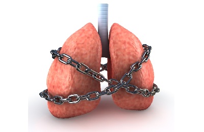 Рекомендации пациентам с бронхиальной астмой после выписки из стационара thumbnail