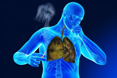 туберкулез и курение