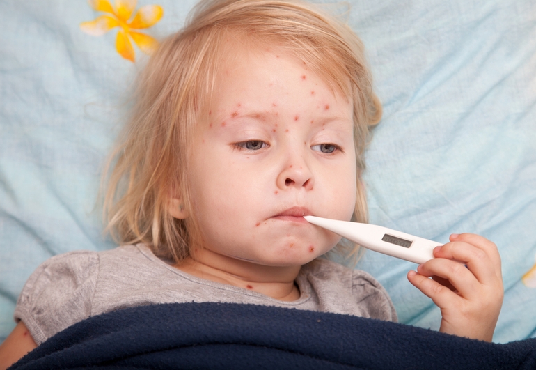 Симптомы и лечение краснухи у детей