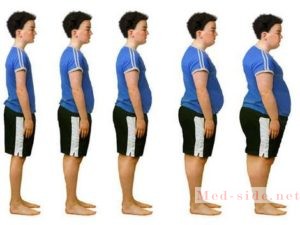 Когда полнота перерастает в абдоминальное ожирение, критерии оценки веса тела и способы борьбы с недугом